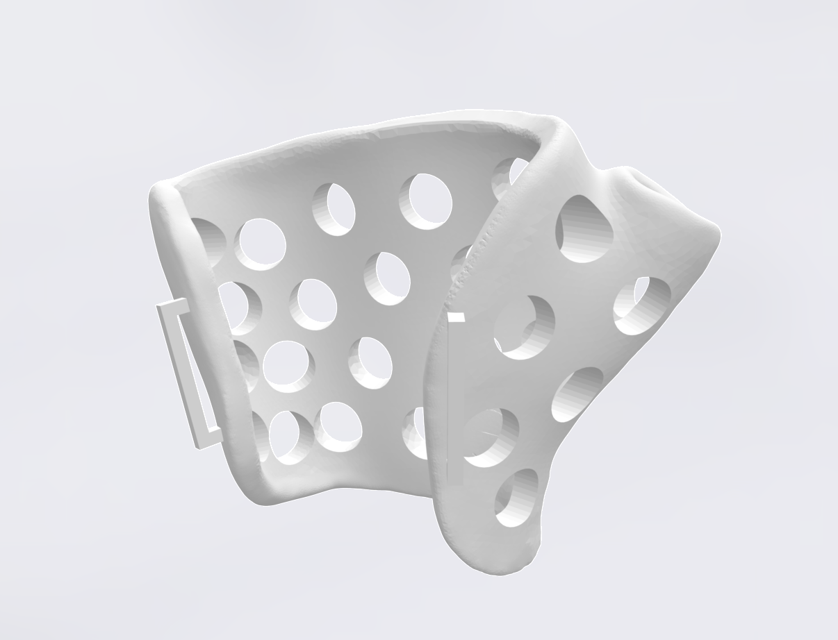 3D printed arm orthosis from 3D CURE in Ethiopia